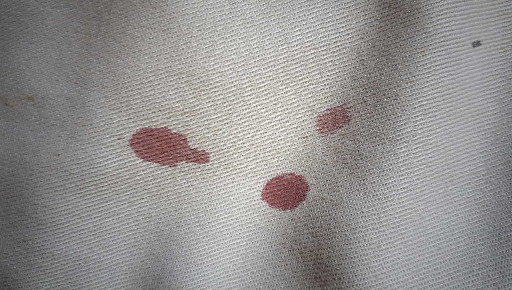 پاک کردن لکه خون از روی لباس‌ها